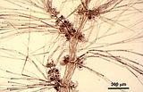 9 - Tetrasporocisti sulle ramificazioni verticillate